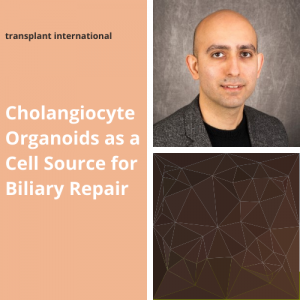 Ebrahimkhani lab publishes News and Views article in transplant international